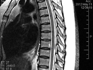 Thoracic MRI