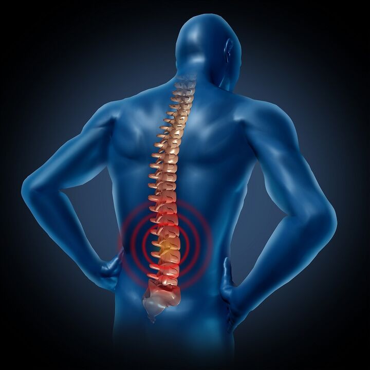 Waist back pain