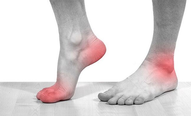 Ankle pain with arthropathy
