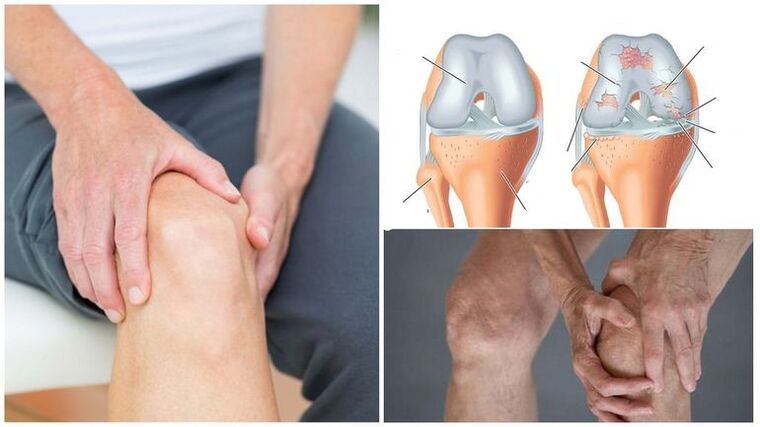 Symptoms of knee pain in the joints