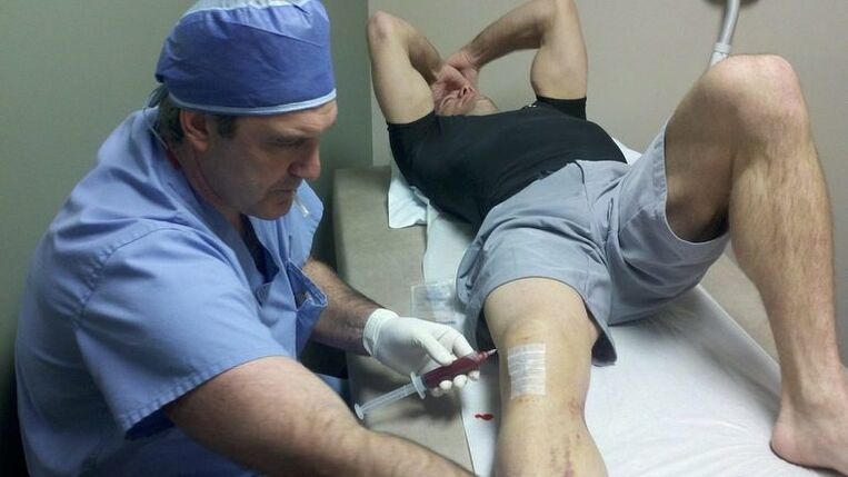 Treat the joints of the knee joints