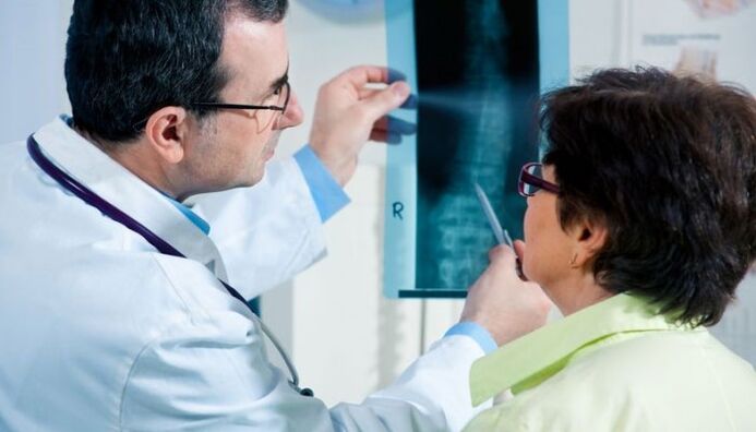 Radiography as a diagnostic method for cervical osteochondrosis