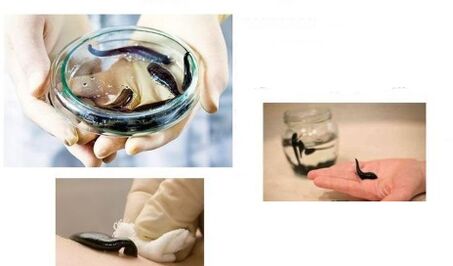 Leech therapy for joint disease