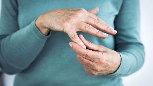 osteoarthritis of the fingers